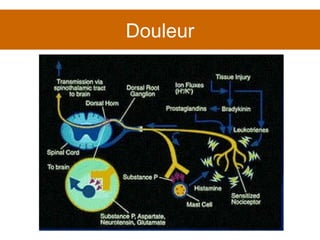 Douleur 