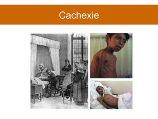 Cachexie 
