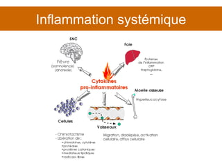 Inflammation systémique 
