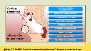 Comprehensive Overview of Peritonitis: Types, Diagnosis, and Treatment ...
