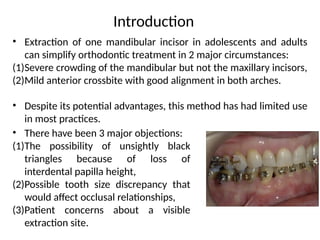 • Extraction of one mandibular incisor in adolescents and adults
can simplify orthodontic treatment in 2 major circumstances:
(1)Severe crowding of the mandibular but not the maxillary incisors,
(2)Mild anterior crossbite with good alignment in both arches.
• Despite its potential advantages, this method has had limited use
in most practices.
Introduction
• There have been 3 major objections:
(1)The possibility of unsightly black
triangles because of loss of
interdental papilla height,
(2)Possible tooth size discrepancy that
would affect occlusal relationships,
(3)Patient concerns about a visible
extraction site.
 