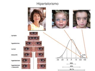 5 la genetica clínica en pediatria