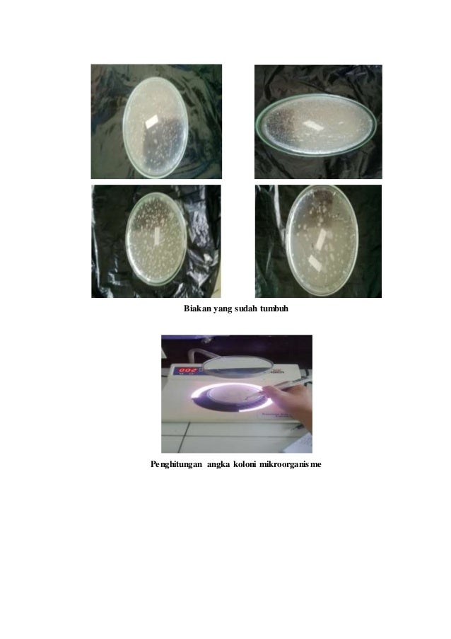 Lampiran KTI (Form ceklis pencucian, pengenceran