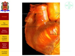 Anatomia do sistema circulatório
Coração
Vias
circulatórias
Aorta e
seus ramos
Veias da
circulação
sistêmica
Sistema
porta
hepática
Circulação
pulmonar
 