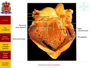Anatomia do sistema circulatório
Fibras de Purkinje
Coração
Vias
circulatórias
Aorta e
seus ramos
Veias da
circulação
sistêmica
Sistema
porta
hepática
Circulação
pulmonar
Septo
interventricular
Ramos do
ramo esquerdo
Mm papilares
 