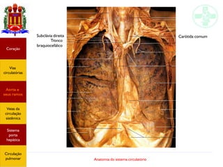 Anatomia do sistema circulatório
Coração
Vias
circulatórias
Aorta e
seus ramos
Veias da
circulação
sistêmica
Sistema
porta
hepática
Circulação
pulmonar
Subclávia direita
Tronco
braquiocefálico
Carótida comum
 