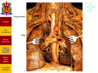Anatomia do sistema circulatório
Coração
Vias
circulatórias
Aorta e
seus ramos
Veias da
circulação
sistêmica
Sistema
porta
hepática
Circulação
pulmonar
Ázigo
Braquiocefálica
 