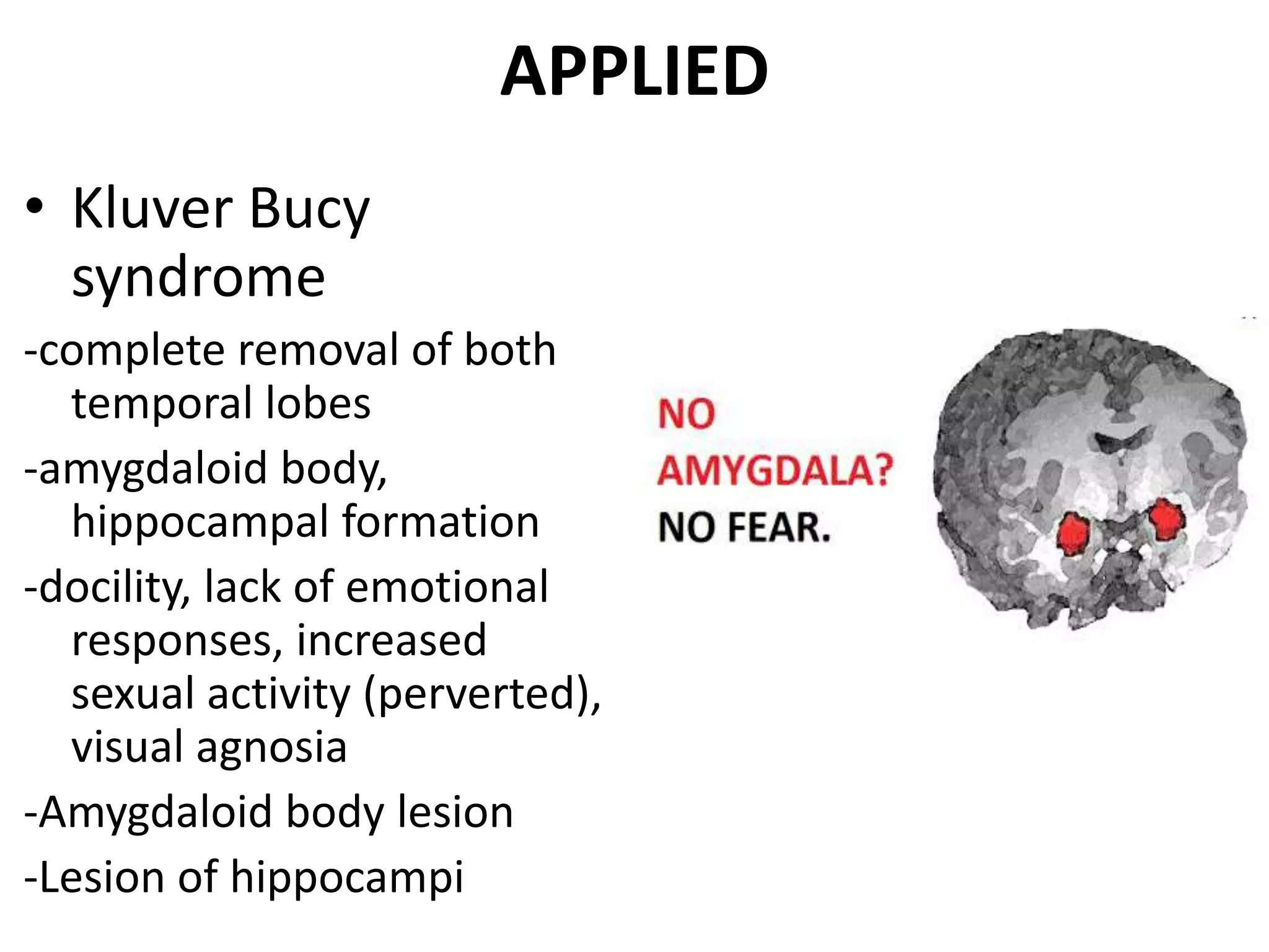 APPLIED
• Kluver Bucy
  syndrome
-complete removal of both
  temporal lobes
-amygdaloid body,
  hippocampal formation
-docility, lack of emotional
  responses, increased
  sexual activity (perverted),
  visual agnosia
-Amygdaloid body lesion
-Lesion of hippocampi
 