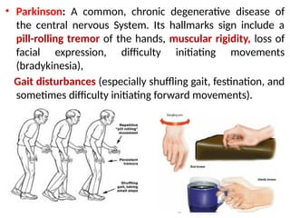 • Parkinson: A common, chronic degenerative disease of
the central nervous System. Its hallmarks sign include a
pill-rolling tremor of the hands, muscular rigidity, loss of
facial expression, difficulty initiating movements
(bradykinesia),
Gait disturbances (especially shuffling gait, festination, and
sometimes difficulty initiating forward movements).
 