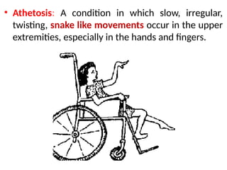 • Athetosis: A condition in which slow, irregular,
twisting, snake like movements occur in the upper
extremities, especially in the hands and fingers.
 