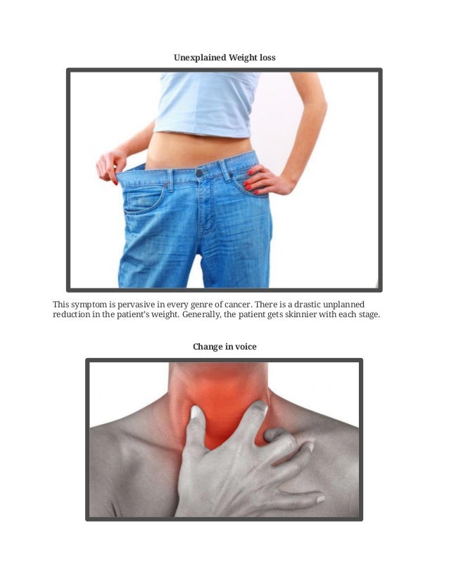 5 major symptoms of throat cancer & its treatment