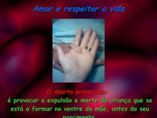 O aborto provocado: é provocar a expulsão e morte da criança que se está a formar no ventre da mãe, antes do seu nascimento. Amar e respeitar a vida 