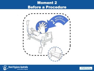 Moment 2
Before a Procedure
 