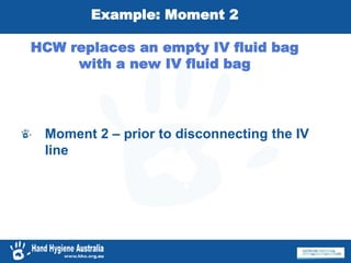 Example: Moment 2
HCW replaces an empty IV fluid bag
with a new IV fluid bag
Moment 2 – prior to disconnecting the IV
line
 