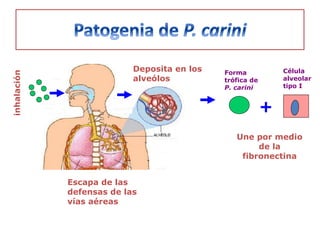Deposita en los   Forma            Célula
inhalación




                           alveólos          trófica de       alveolar
                                             P. carini        tipo I


                                                          +
                                                Une por medio
                                                     de la
                                                 fibronectina


             Escapa de las
             defensas de las
             vías aéreas
 