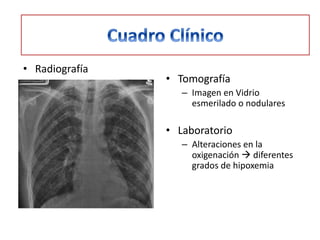 • Radiografía
                • Tomografía
                   – Imagen en Vidrio
                     esmerilado o nodulares

                • Laboratorio
                   – Alteraciones en la
                     oxigenación  diferentes
                     grados de hipoxemia
 