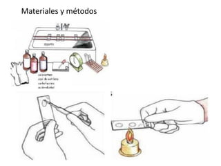 Materiales y métodos
 