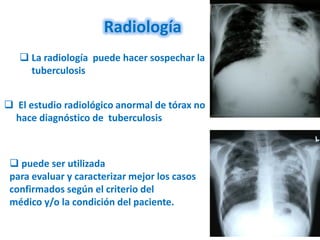 Radiología
    La radiología puede hacer sospechar la
     tuberculosis


 El estudio radiológico anormal de tórax no
  hace diagnóstico de tuberculosis



  puede ser utilizada
 para evaluar y caracterizar mejor los casos
 confirmados según el criterio del
 médico y/o la condición del paciente.
 