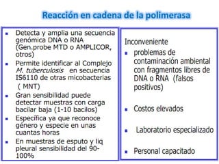 Reacción en cadena de la polimerasa
 