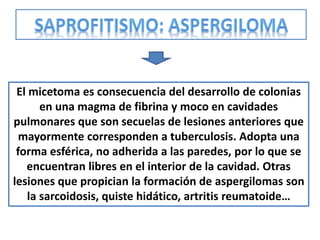 El micetoma es consecuencia del desarrollo de colonias
       en una magma de fibrina y moco en cavidades
pulmonares que son secuelas de lesiones anteriores que
  mayormente corresponden a tuberculosis. Adopta una
 forma esférica, no adherida a las paredes, por lo que se
   encuentran libres en el interior de la cavidad. Otras
lesiones que propician la formación de aspergilomas son
    la sarcoidosis, quiste hidático, artritis reumatoide…
 
