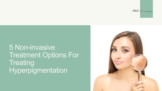 5 Non-invasive
Treatment Options For
Treating
Hyperpigmentation
 