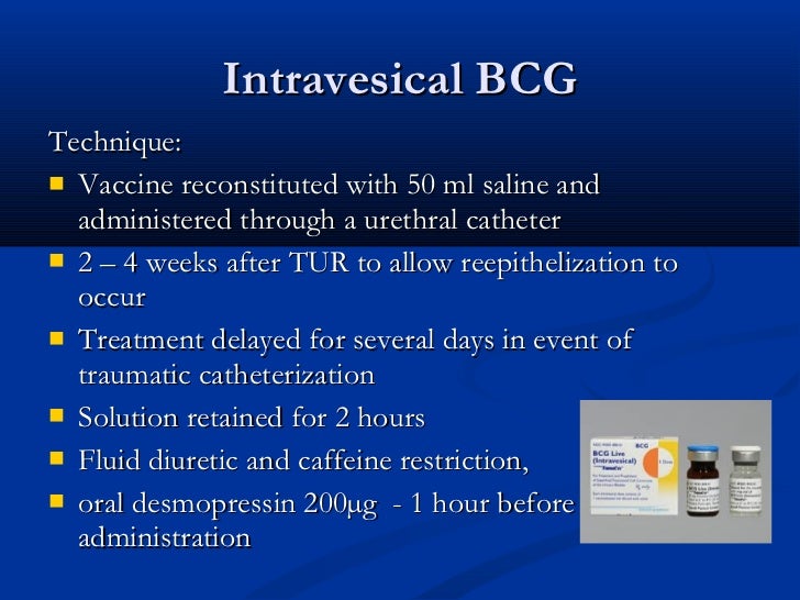 Complications Of Intravesical Bcg Immunotherapy For Bladder Cancer Radiographics