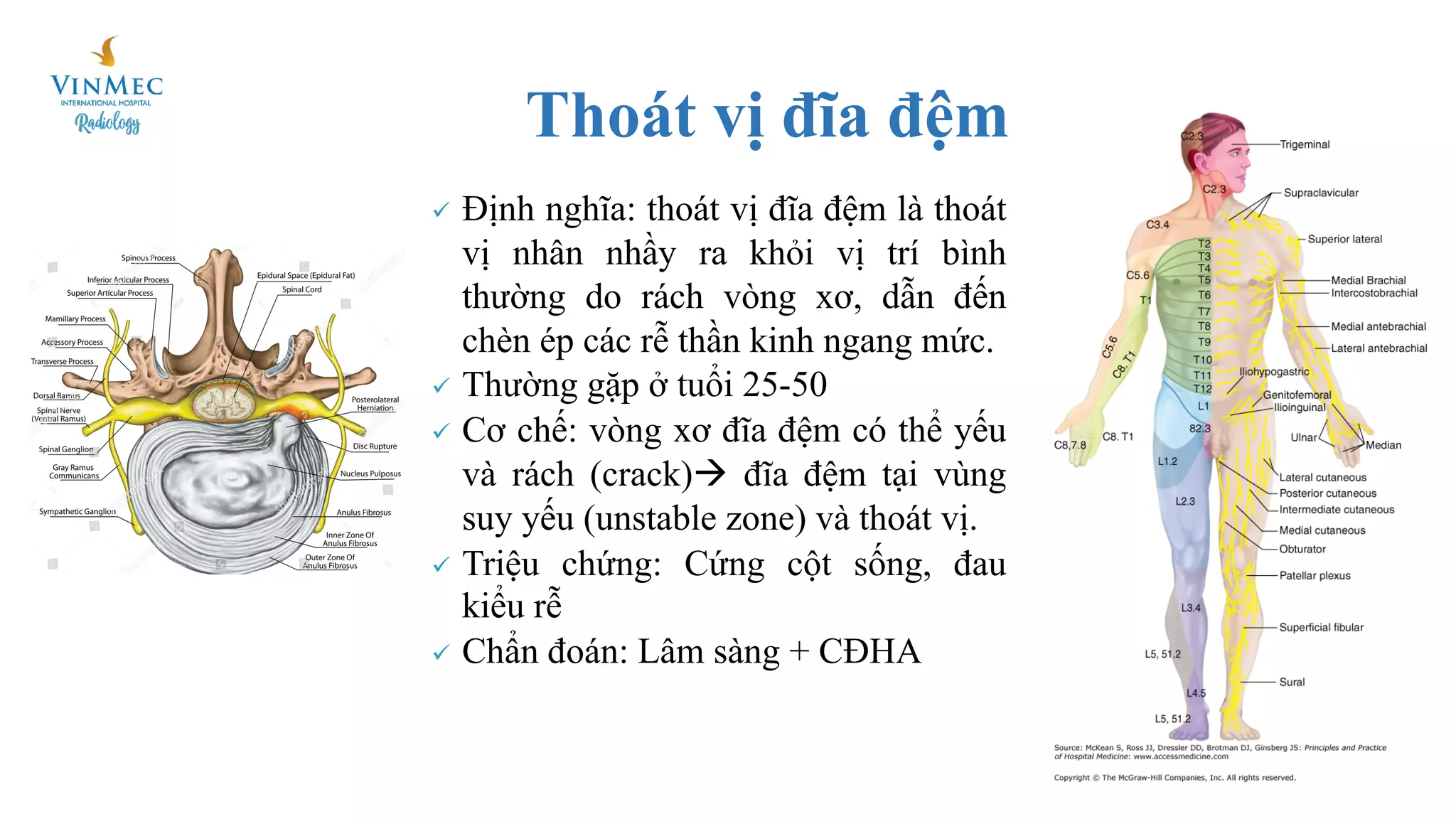 Discogel Tiêm Discogel điều trị thoát vị đĩa đệm | PDF