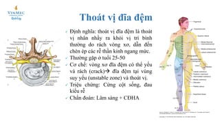 Tiêm Discogel điều trị thoát vị đĩa đệm | PDF