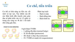 Discogel Tiêm Discogel điều trị thoát vị đĩa đệm | PDF
