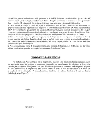 de SG 5% e gotejar inicialmente 8 a 10 gotas/min (4 a 5m UI). Aumentar, se necessário, 4 gotas a cada 15
minutos até atingir 3 contrações em 10’ de 40-50” de duração. O máximo de miliunidades/min. permitido
é de 16 mui/m (32 gotas/min). Em gestação de termo, para se ter uma estimulação fisiológica.
c) Se a dilatação atingir a linha de ação, é mandatório uma revisão cuidadosa das condições de
proporcionalidade entre o polo cefálico e a pelve, no sentido de diagnosticar uma DCP uma vez afastada a
DCP, deve-se instalar o gotejamento de ocitocina. Diante de DCP, está indicada a interupção do T.P. por
cesareana. A cesarea também estará indicada toda vez que houver a presença de sinais de sofrimento fetal,
insucesso na dilatação progressiva do colo e aumento da moldagem cefálica sem descida da cabeça.
d) Em todos os casos de indução, ou progresso na dilatação deve ficar superior a 1 cm/hora e deverá
ocorrer descida satisfatória da cabeça fetal, para se definir como uma resposta a estimulação ocitócica.
Isso geralmente acontecerá dentro de duas horas após o início do gotejamento de ocitocina nas pacientes
que evoluirão para parto vaginal.
e) Nos casos em que a curva de dilatação ultrapassar a linha de alerta em menos de 2 horas, não devemos
utilizar ocitócicos e aguardar a evolução espontânea do Trabalho de Parto.
DIAGNÓSTICO DAS DISTÓCIAS
O Trabalho de Parto distócico não é diagnóstico, mas sim sinal de anormalidade cuja causa deve
ser procurada antes de instituir o tratamento adequado. A identificação das distócias é feita pela
observação da curva de dilatação cervical e da descida da apresentação expressas no Partograma. (Figura
4). Essa identificação é simplificada pelo uso de linhas de alerta e ação estabelecendo as 3 zonas de
evolução da cérvico-dilatação : À esquerda da linha de alerta, entre a linha de alerta e de ação e a direita
da linha de ação (Figura 5)
espaço
FIGURA 5
 