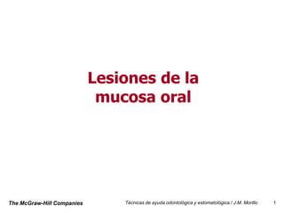 Lesiones de la
                             mucosa oral




The McGraw-Hill Companies       Técnicas de ayuda odontológica y estomatológica / J.M. Morillo   1
 