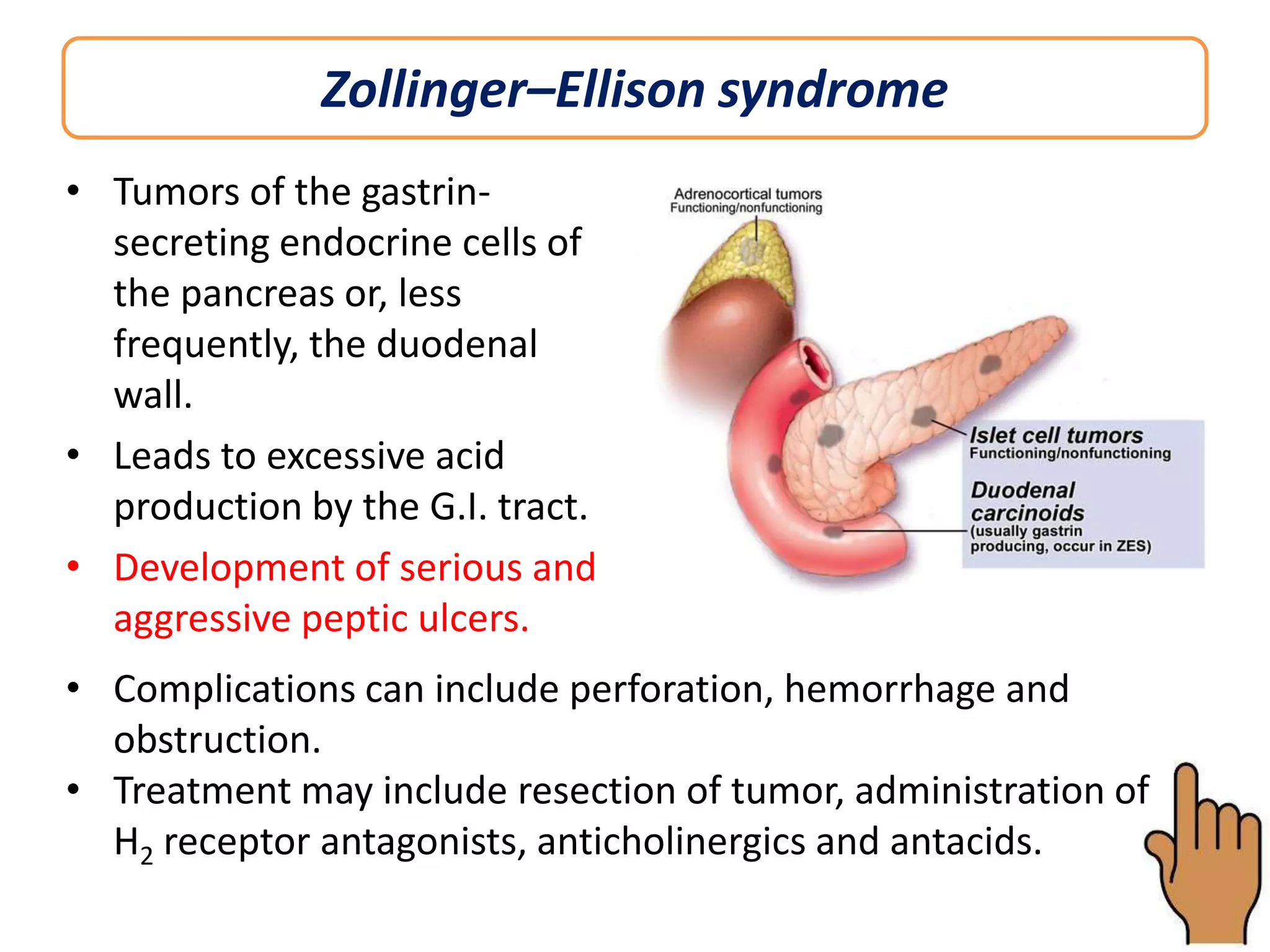 Zollinger–Ellison syndrome
• Tumors of the gastrinsecreting endocrine cells of
the pancreas or, less
frequently, the duodenal
wall.
• Leads to excessive acid
production by the G.I. tract.
• Development of serious and
aggressive peptic ulcers.
• Complications can include perforation, hemorrhage and
obstruction.
• Treatment may include resection of tumor, administration of
H2 receptor antagonists, anticholinergics and antacids.

 