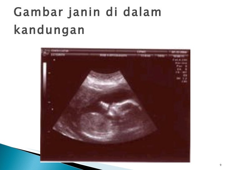 5 periode prenatal