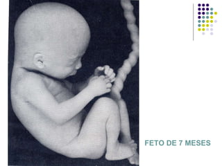 FETO DE 7 MESES 