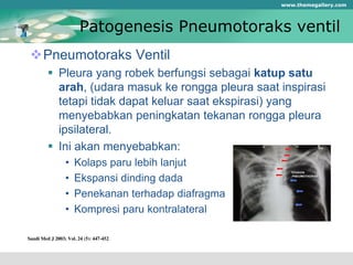 Patogenesis Pneumotoraks ventil
Pneumotoraks Ventil
 Pleura yang robek berfungsi sebagai katup satu
arah, (udara masuk ke rongga pleura saat inspirasi
tetapi tidak dapat keluar saat ekspirasi) yang
menyebabkan peningkatan tekanan rongga pleura
ipsilateral.
 Ini akan menyebabkan:
• Kolaps paru lebih lanjut
• Ekspansi dinding dada
• Penekanan terhadap diafragma
• Kompresi paru kontralateral
www.themegallery.com
 