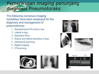 Pemeriksaan imaging penunjang
diagnosis Pneumotoraks
The following numerous imaging
modalities have been employed for the
diagnosis and management of
pneumothorax:
1. Standard erect PA chest x-ray.
2. Lateral x-rays.
3. Expiratory films.
4. Supine and lateral decubitus x-rays.
5. Ultrasound scanning.
6. Digital imaging.
7. CTscanning.
 