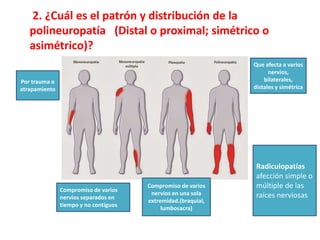 2. ¿Cuál es el patrón y distribución de la
polineuropatía (Distal o proximal; simétrico o
asimétrico)?
Por trauma o
atrapamiento
Compromiso de varios
nervios separados en
tiempo y no contiguos
Que afecta a varios
nervios,
bilaterales,
distales y simétrica
Compromiso de varios
nervios en una sola
extremidad.(braquial,
lumbosacra)
Radiculopatías
afección simple o
múltiple de las
raíces nerviosas
 