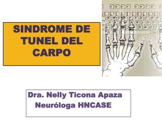 SINDROME DE
TUNEL DEL
CARPO
Dra. Nelly Ticona Apaza
Neuróloga HNCASE
 
