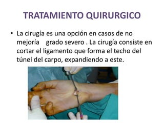 TRATAMIENTO QUIRURGICO
• La cirugía es una opción en casos de no
mejoría grado severo . La cirugía consiste en
cortar el ligamento que forma el techo del
túnel del carpo, expandiendo a este.
 