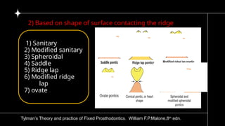 5)pontic and pontic designs [Autosaved].pptx
