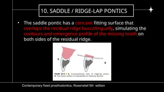 5)pontic and pontic designs [Autosaved].pptx