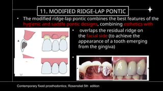 5)pontic and pontic designs [Autosaved].pptx