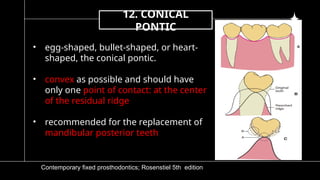 5)pontic and pontic designs [Autosaved].pptx