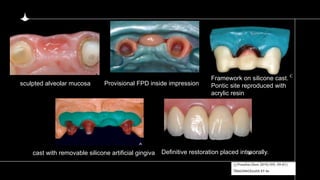 5)pontic and pontic designs [Autosaved].pptx