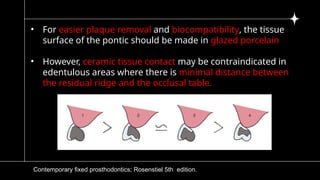 5)pontic and pontic designs [Autosaved].pptx