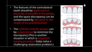 5)pontic and pontic designs [Autosaved].pptx