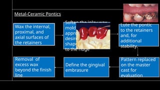 5)pontic and pontic designs [Autosaved].pptx