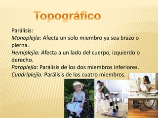Parálisis:
Monoplejía: Afecta un solo miembro ya sea brazo o
pierna.
Hemiplejía: Afecta a un lado del cuerpo, izquierdo o
derecho.
Paraplejía: Parálisis de los dos miembros inferiores.
Cuadriplejía: Parálisis de los cuatro miembros.
 