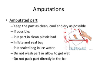 Amputations
• Amputated part
– Keep the part as clean, cool and dry as possible
– If possible:
– Put part in clean plastic bad
– Inflate and seal bag
– Put sealed bag in ice water
– Do not wash part or allow to get wet
– Do not pack part directly in the ice
 