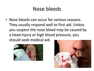 Nose bleeds
• Nose bleeds can occur for various reasons.
They usually respond well to first aid. Unless
you suspect the nose bleed may be caused by
a head injury or high blood pressure, you
should seek medical aid.
 